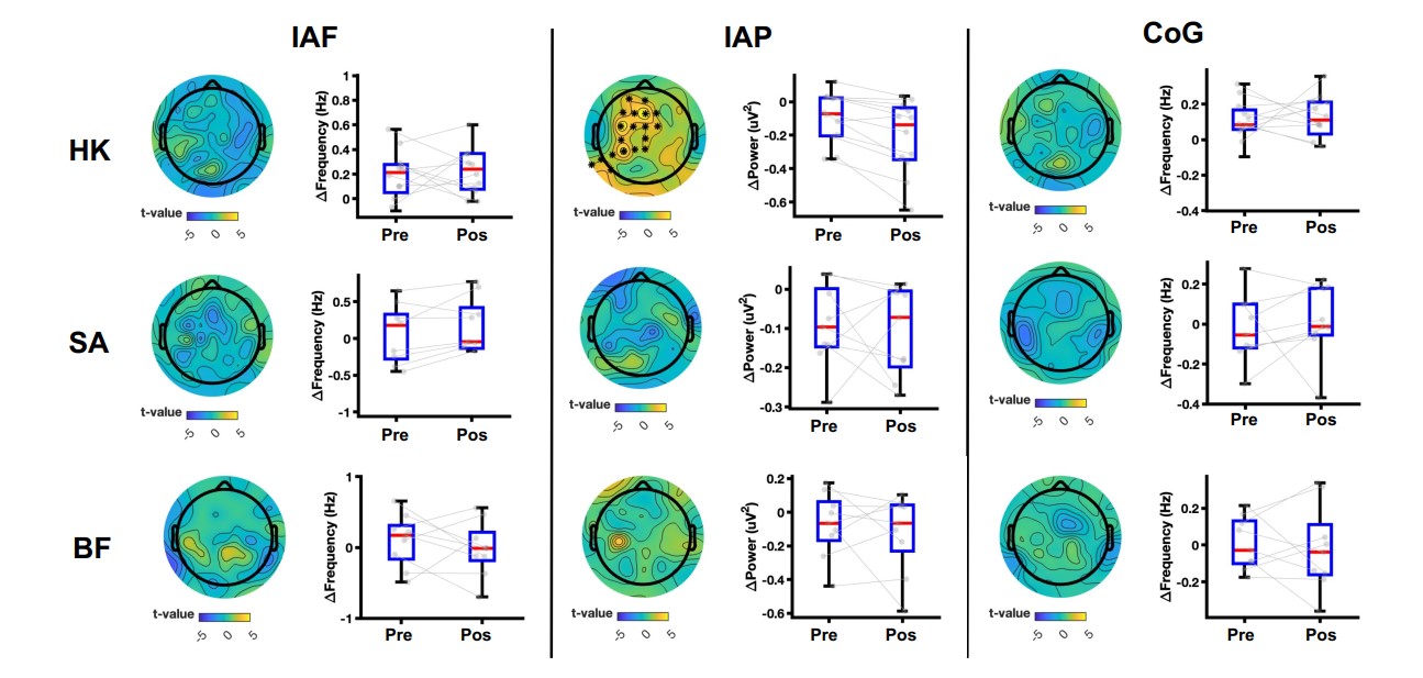 Long-term Neuroplasticity